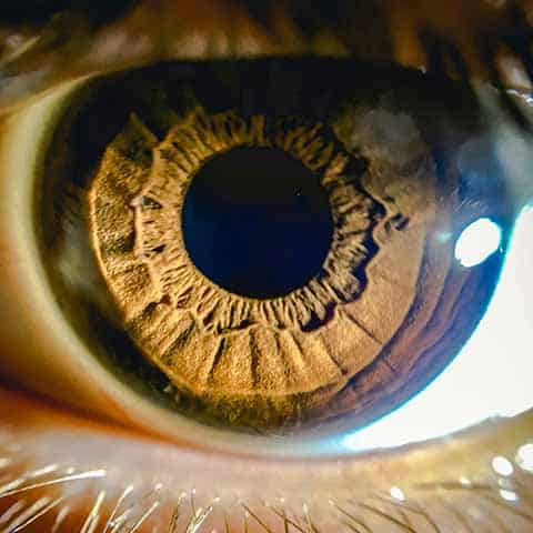 Glaucoma & Macular Degeneration